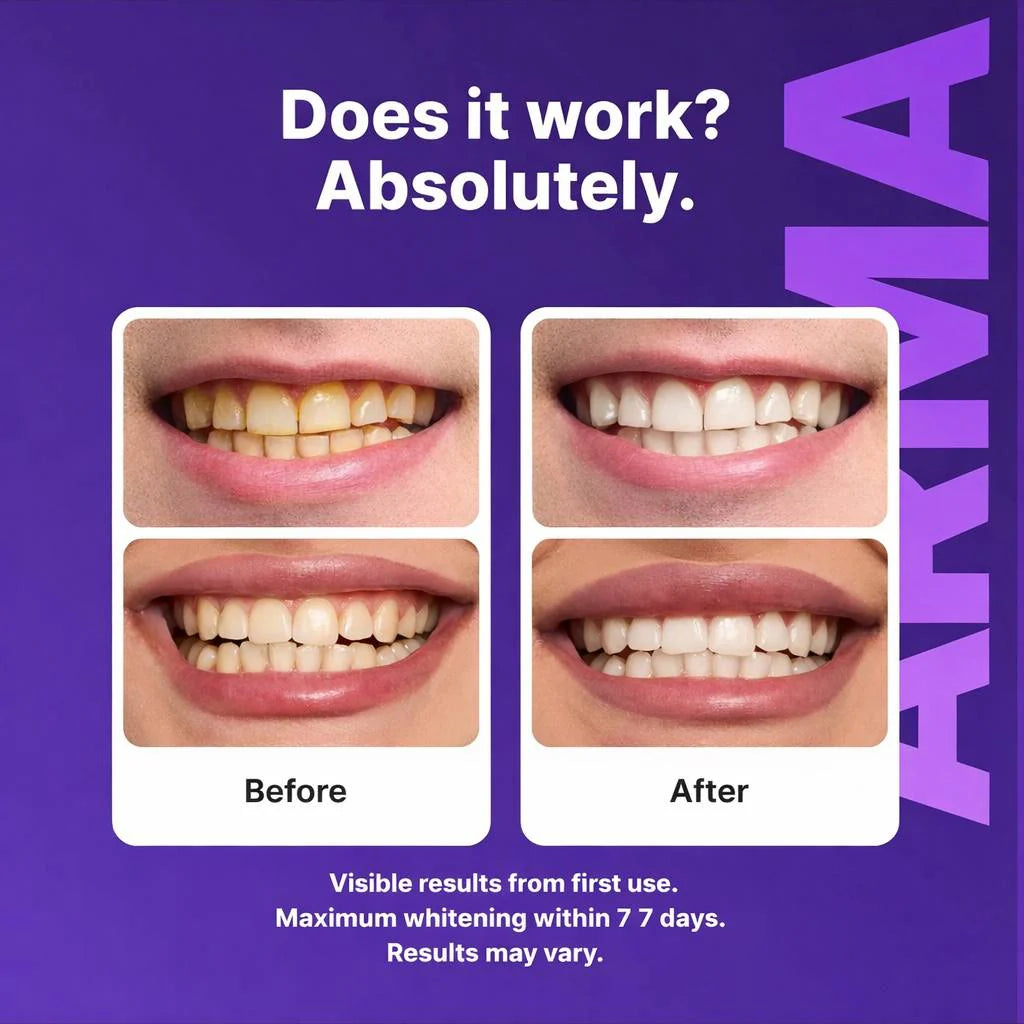 ARMA - Purple Teeth Whitening Strips